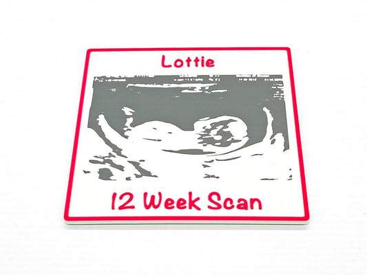 3D Baby Scan Plaque | Pink / Blue